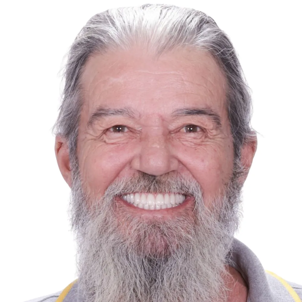 Caso clínico 4 concluído no Instituto RS